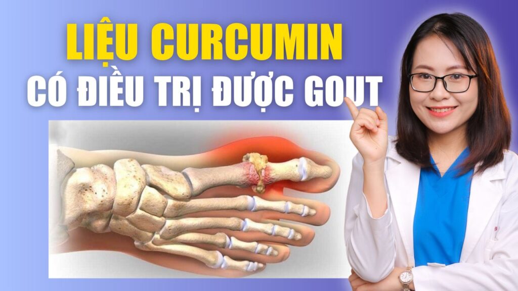 Tác dụng của curcumin trong điều trị bệnh gout Bs Huyền