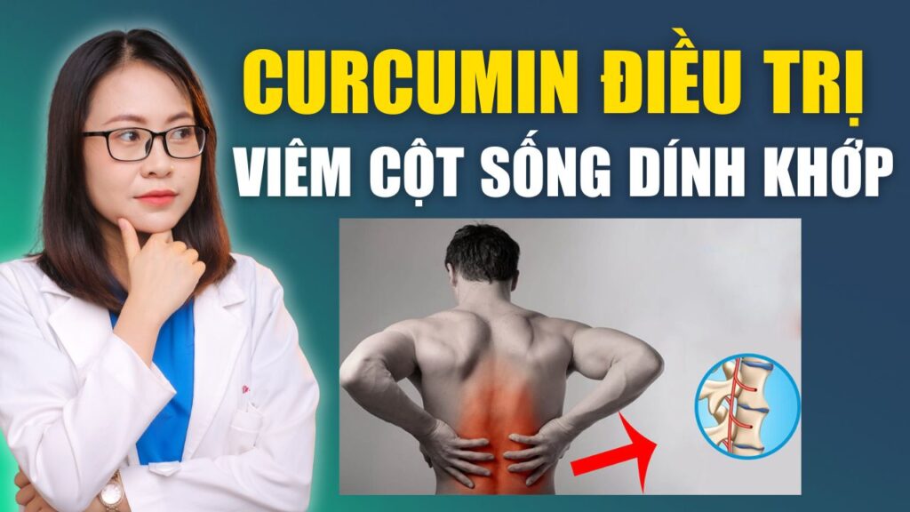 Curcumin điều trị viêm cột sống dính khớp Bs Huyền