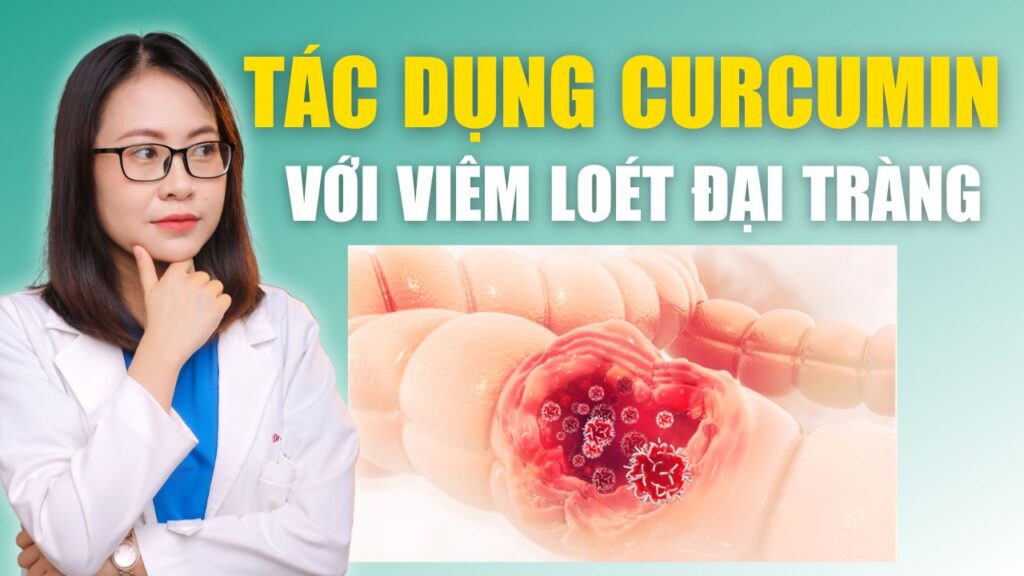 Tác dụng của curcumin đối với viêm loét đại tràng Bs Huyền