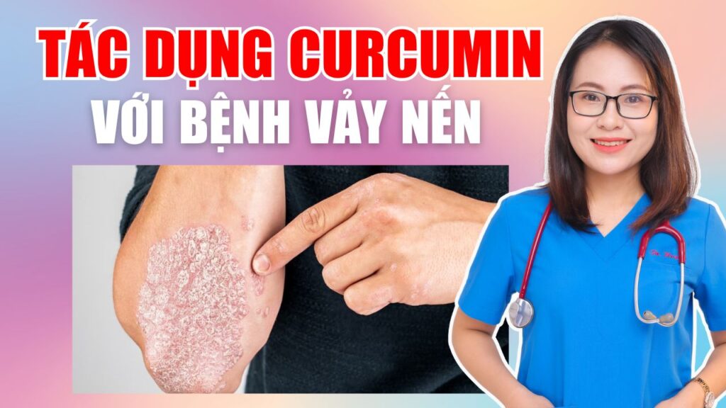 Tác dụng của curcumin đối với bệnh vảy nến Bs Huyền