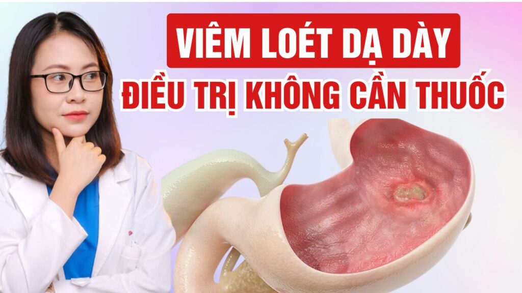 Điều trị viêm loét dạ dày Bs Huyền